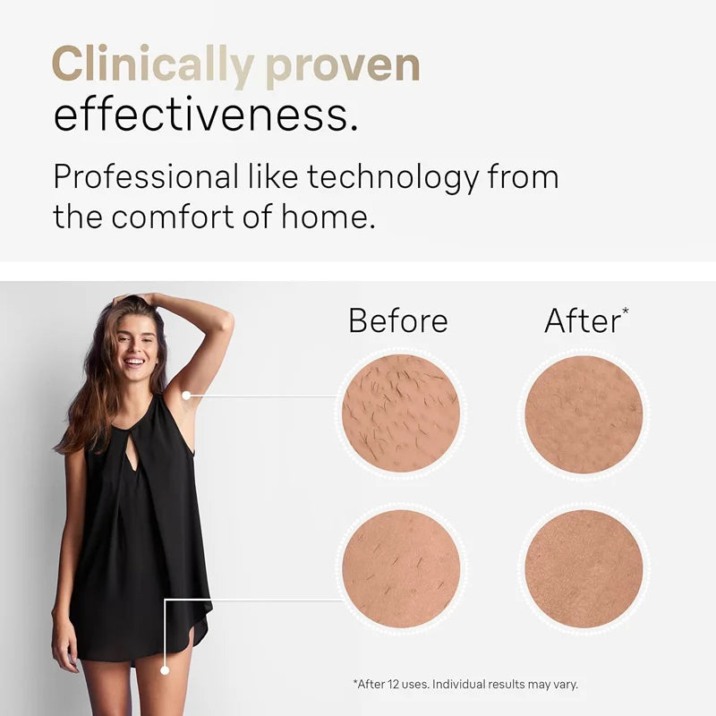 Depilador Láser Oumonoka